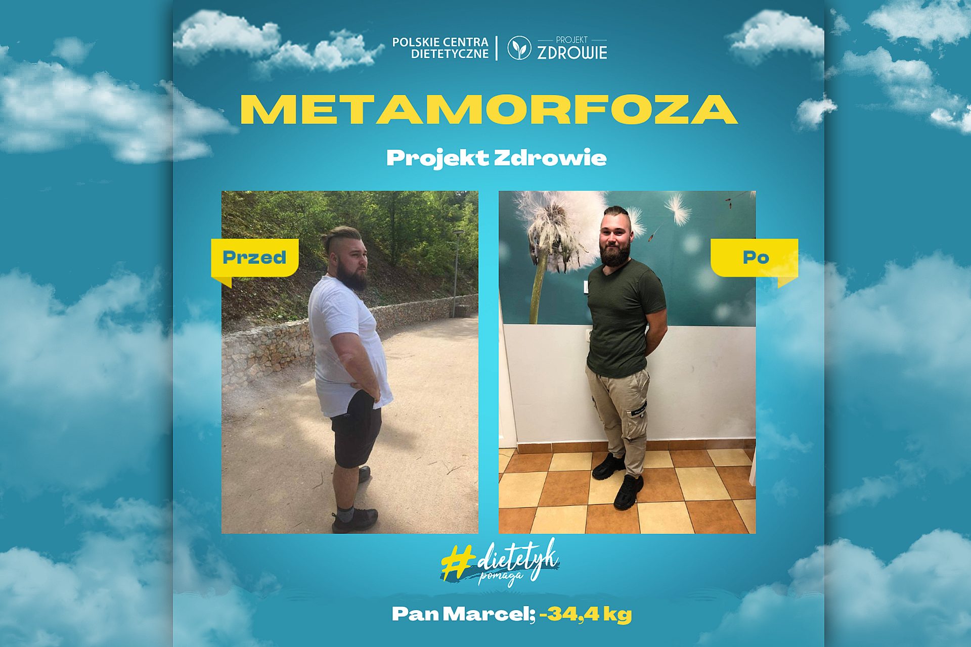 Metamorfoza zdjęcie główne Metamorfoza zdjęcie główne