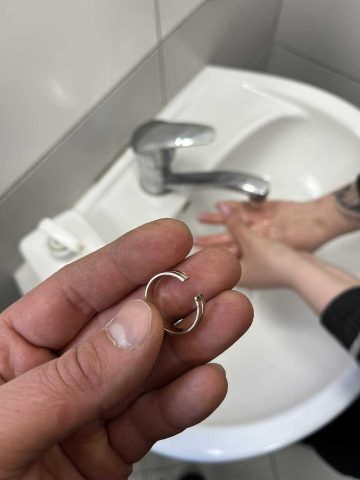 Strażacy zdjęli obrączkę z palca Strażacy zdjęli obrączkę z palca