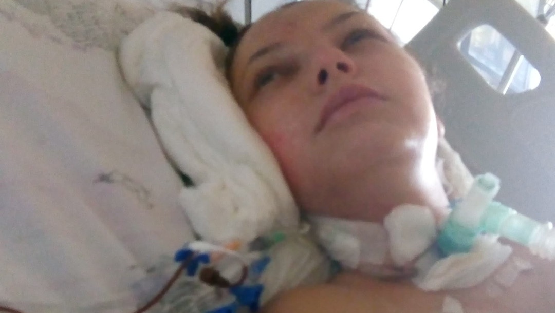 Maja w szpitalu po wypadku
